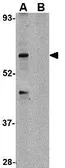 Anti-TRIM25 antibody used in Western Blot (WB). GTX31323