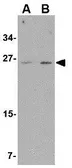 Anti-ARMET antibody used in Western Blot (WB). GTX31324