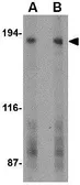Anti-GPR124 antibody used in Western Blot (WB). GTX31326