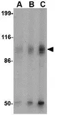 Anti-GluR6 antibody used in Western Blot (WB). GTX31328