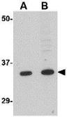 Anti-GRTP1 antibody used in Western Blot (WB). GTX31339
