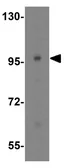 Anti-TNPO3 antibody used in Western Blot (WB). GTX31343