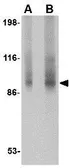 Anti-TNPO3 antibody used in Western Blot (WB). GTX31344