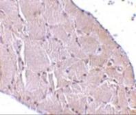 Anti-Wnt10a antibody used in IHC (Paraffin sections) (IHC-P). GTX31345