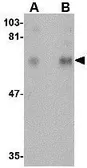 Anti-CPEB1 antibody used in Western Blot (WB). GTX31347
