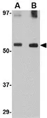 Anti-GDF6 antibody used in Western Blot (WB). GTX31348