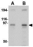 Anti-NUP107 antibody used in Western Blot (WB). GTX31351