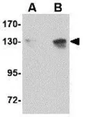 Anti-NUP155 antibody used in Western Blot (WB). GTX31353
