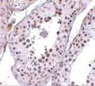 Anti-MED4 antibody used in IHC (Paraffin sections) (IHC-P). GTX31355