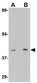 Anti-EDG1 antibody used in Western Blot (WB). GTX31360