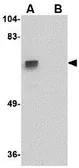 Anti-ZNF350 antibody used in Western Blot (WB). GTX31362