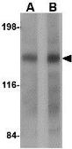 Anti-DISP2 antibody used in Western Blot (WB). GTX31364