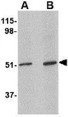 Anti-LASS5 antibody used in Western Blot (WB). GTX31365