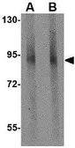 Anti-GLE1 antibody used in Western Blot (WB). GTX31366