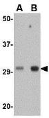 Anti-TREX1 antibody used in Western Blot (WB). GTX31367