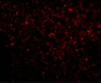 Anti-TREX1 antibody used in IHC (Paraffin sections) (IHC-P). GTX31367