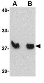 Anti-KLRA1 antibody used in Western Blot (WB). GTX31371