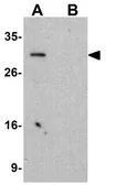 Anti-KCTD15 antibody used in Western Blot (WB). GTX31374