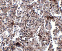 Anti-KCTD15 antibody used in IHC (Paraffin sections) (IHC-P). GTX31374