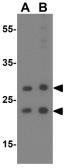 Anti-SCF antibody used in Western Blot (WB). GTX31379