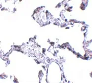 Anti-CD81 antibody used in IHC (Paraffin sections) (IHC-P). GTX31381