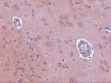 Anti-FAM120A antibody used in IHC (Paraffin sections) (IHC-P). GTX31385