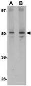 Anti-PSR antibody used in Western Blot (WB). GTX31387