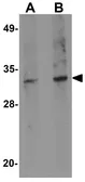 Anti-SKA1 antibody used in Western Blot (WB). GTX31390
