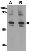 Anti-GOLPH2 antibody used in Western Blot (WB). GTX31391