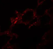 Anti-SGK493 antibody used in IHC (Paraffin sections) (IHC-P). GTX31396
