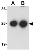 Anti-Synaptogyrin 3 antibody used in Western Blot (WB). GTX31397