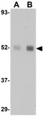 Anti-LXR beta antibody used in Western Blot (WB). GTX31398