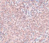 Anti-Nanog antibody used in IHC (Paraffin sections) (IHC-P). GTX31400