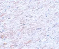 Anti-TCF3 / E2A antibody used in IHC (Paraffin sections) (IHC-P). GTX31402