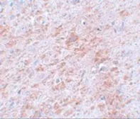 Anti-DCAMKL2 antibody used in IHC (Paraffin sections) (IHC-P). GTX31404