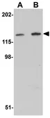 Anti-MYBPC2 antibody used in Western Blot (WB). GTX31405