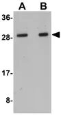 Anti-LYRM1 antibody used in Western Blot (WB). GTX31407