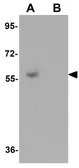 Anti-PIAS1 antibody used in Western Blot (WB). GTX31410