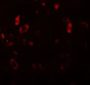 Anti-PIAS2 antibody used in IHC (Paraffin sections) (IHC-P). GTX31411