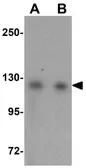 Anti-USP10 antibody used in Western Blot (WB). GTX31416