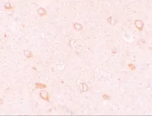 Anti-CIITA antibody used in IHC (Paraffin sections) (IHC-P). GTX31419