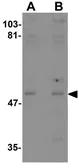 Anti-KPNA3 antibody used in Western Blot (WB). GTX31420
