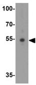 Anti-TRIP6 antibody used in Western Blot (WB). GTX31421