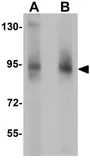 Anti-ZBTB5 antibody used in Western Blot (WB). GTX31423
