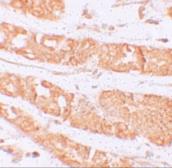 Anti-CD168 / RHAMM antibody used in IHC (Paraffin sections) (IHC-P). GTX31428