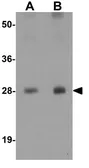 Anti-TM4SF1 antibody used in Western Blot (WB). GTX31430