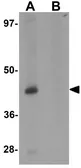 Anti-Protor 1 antibody used in Western Blot (WB). GTX31436