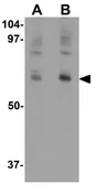 Anti-NUMB antibody used in Western Blot (WB). GTX31439