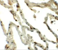 Anti-Translin antibody used in IHC (Paraffin sections) (IHC-P). GTX31440