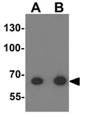 Anti-Tektin 5 antibody used in Western Blot (WB). GTX31443